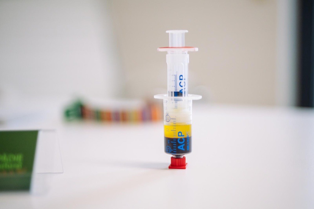 ACP-Doppelkammerspritze mit Plasma und Bluttrennschicht in der Orthopädie am Königsforst