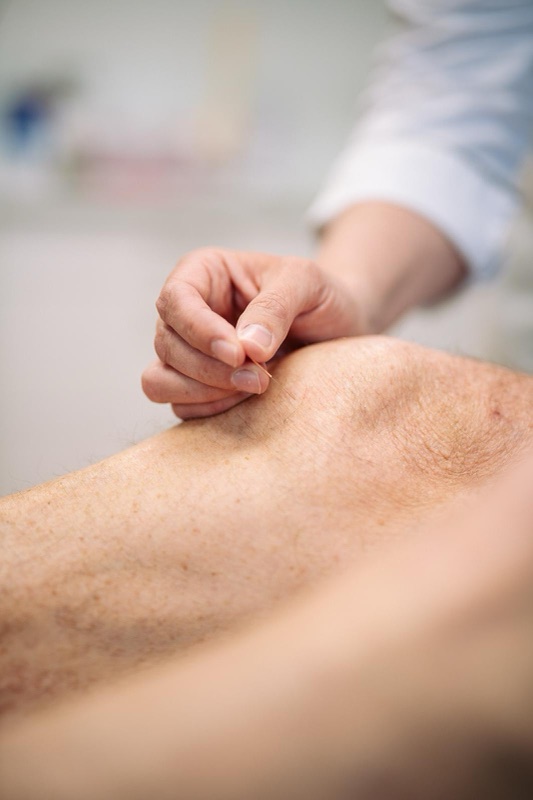 Akupunktur in der Orthopädie am Königsforst